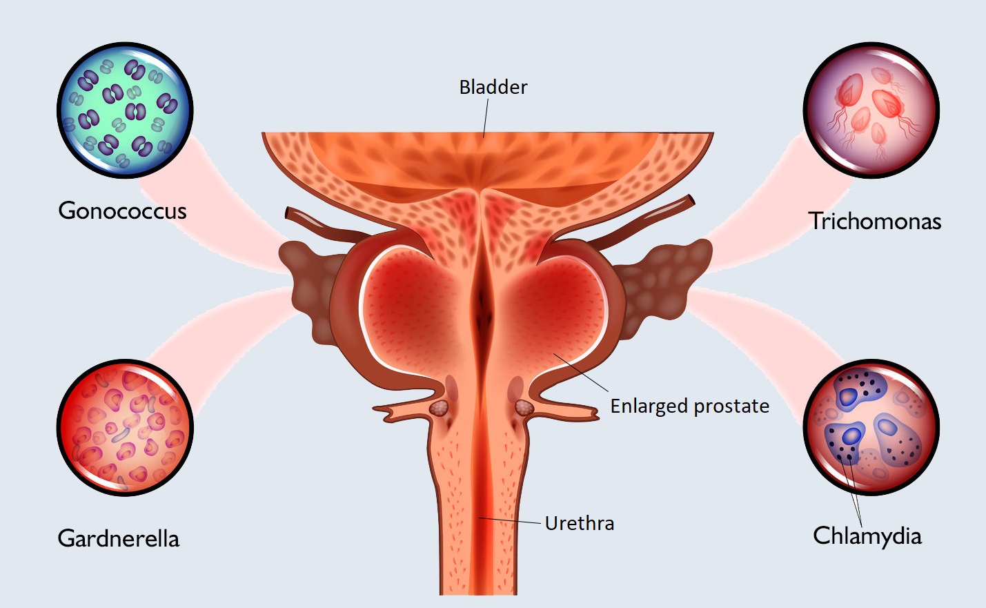STD symptoms